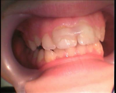 Leo4 vgarro - Eugenol