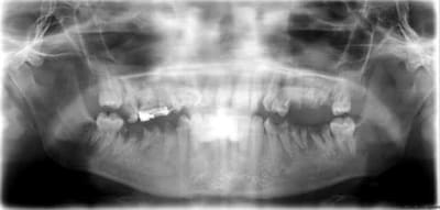 Lfl yzts4v - Eugenol
