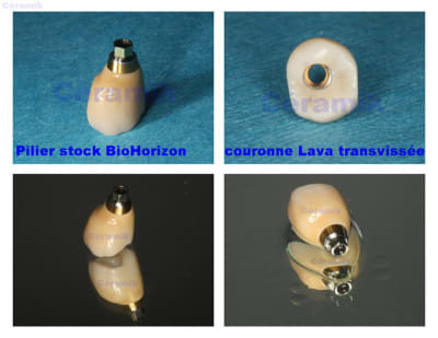 Lava   bio horizon dgwbj9 - Eugenol