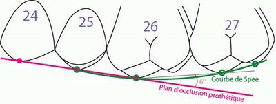 Le montage des dents plan d occlusion proth tique et courbe de spee z7gv0e - Eugenol