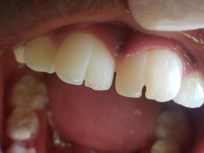 Lys o fa2glm - Eugenol