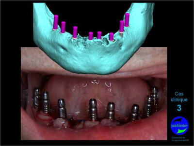 Mcd mise en charge diff r e08 khso2l - Eugenol