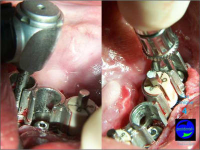 Mcd mise en charge diff r e10 xe9dwy - Eugenol