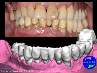 Mci - Eugenol