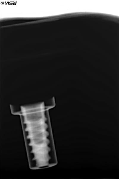 Mis m3emhv - Eugenol