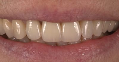 Md cop022 kx0wlo - Eugenol