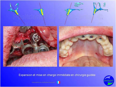 Mise en chage imm diate 189 qqjwjz - Eugenol