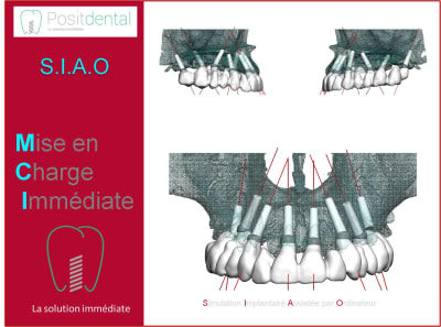 Mise en charge immédiate 004 xfpkxb - Eugenol