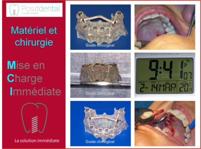 Mise en charge immédiate 005 h5ddjn - Eugenol