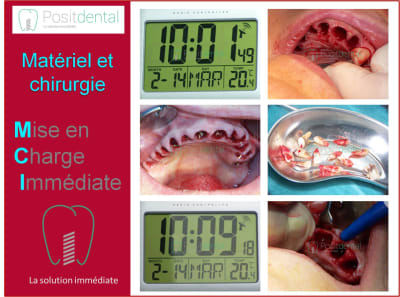 Mise en charge immédiate 006 lgonso - Eugenol