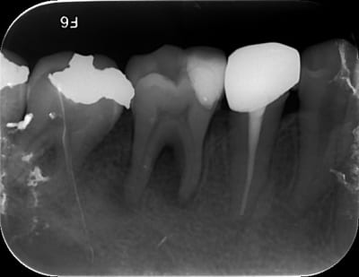N crose pulpaire 46   01122014 vjykji - Eugenol