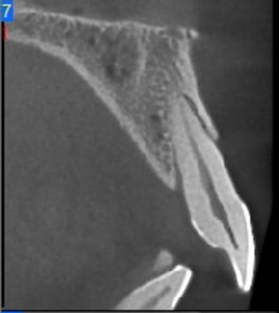 Newtom vg haute definition 3 ys0kj7 - Eugenol