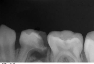 Noah kv4aqt - Eugenol