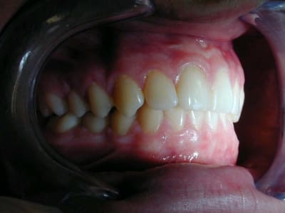 Occ d 2 cm92y1 - Eugenol