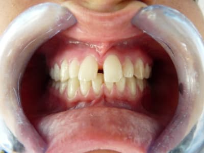 P1000258 xf4upn - Eugenol