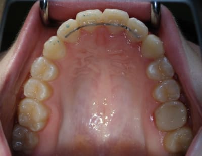 P1010005 m33yjc - Eugenol