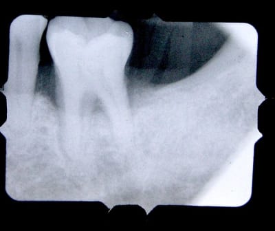 P1010008 dcthqo - Eugenol