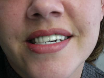 P1010500 mxxrqe - Eugenol