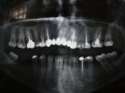 P1010539 ehnsra - Eugenol