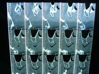 P1050005 jteew9 - Eugenol