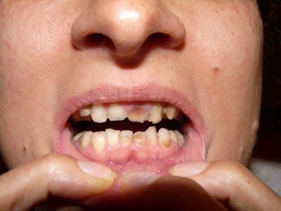 P1070082 rceodh - Eugenol