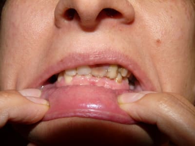 P1070084 od3jc6 - Eugenol