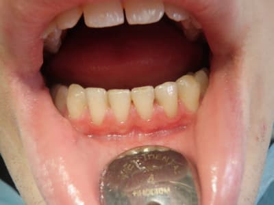 P3030027 psd7um - Eugenol