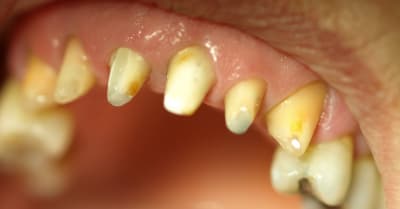 P9165796 orl7kg - Eugenol