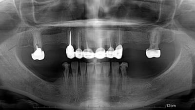 Panorama0 0 uyigem - Eugenol