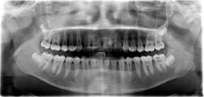 Pano dds o81okl - Eugenol