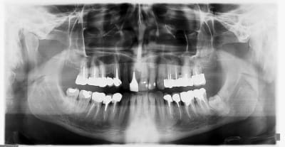 Pano pnzdhh - Eugenol