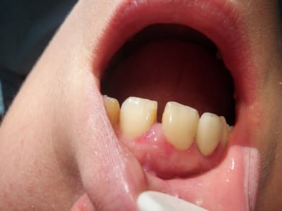 Pc220009 remklg - Eugenol