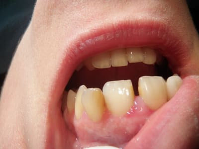 Pc220011 wvstaj - Eugenol