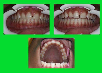 Photos 1 ogara2 - Eugenol