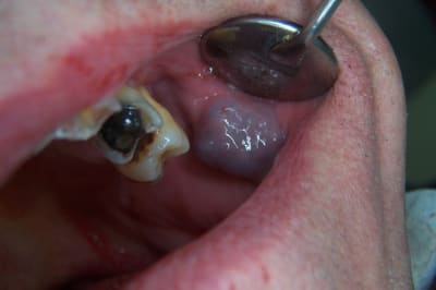 Photo 002 tj4mav - Eugenol