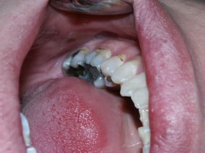 Pict0024 evjsyt - Eugenol