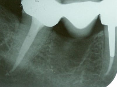 Pict0135 f9ixd3 - Eugenol