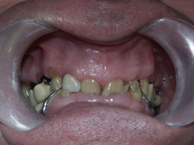 Pict0202 wunpzk - Eugenol