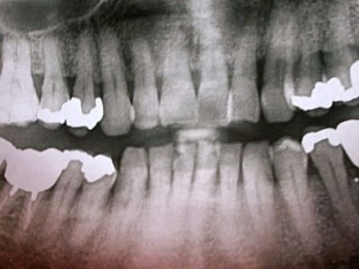Pict0341 g8ny56 - Eugenol