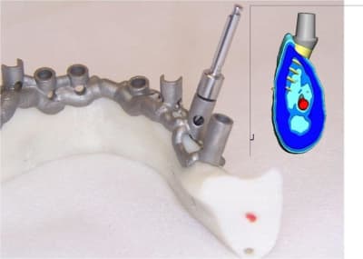 Positdental 4 rhhd8i - Eugenol