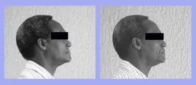Profil 1 dvunna - Eugenol