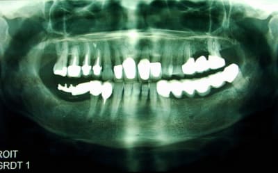 P dsci0001 xz5nec - Eugenol