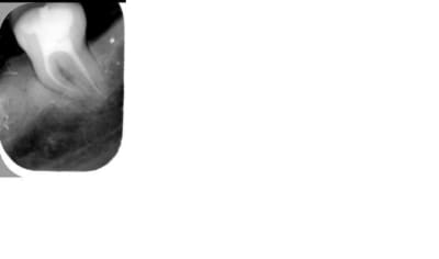 Pac1 svdsvo - Eugenol