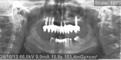 Pano 5 mck7il - Eugenol