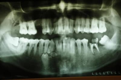 Pano g7wmlw - Eugenol