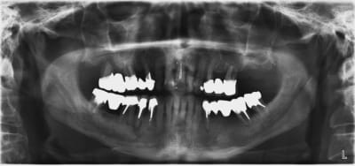 Pano r68mo8 - Eugenol