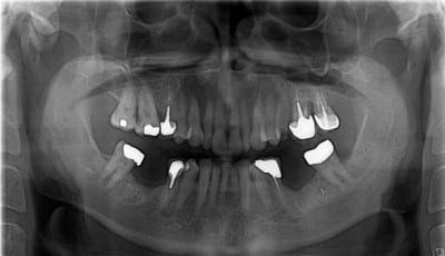 Pano y6gwjv - Eugenol