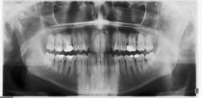 Panobizarre ui55bj - Eugenol