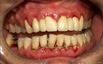 Patient2 qrdz3j - Eugenol