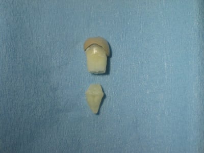 Photo34 003 pbvnbw - Eugenol